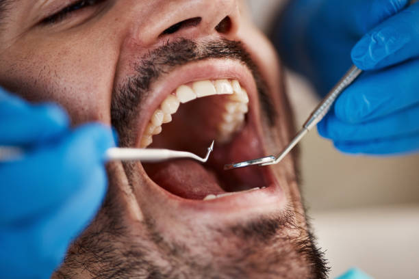 Best Dental Fillings (Composite and Amalgam)  in Frankfort Square, IL