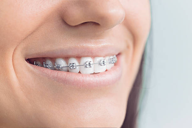Best Veneers and Lumineers  in Frankfort Square, IL